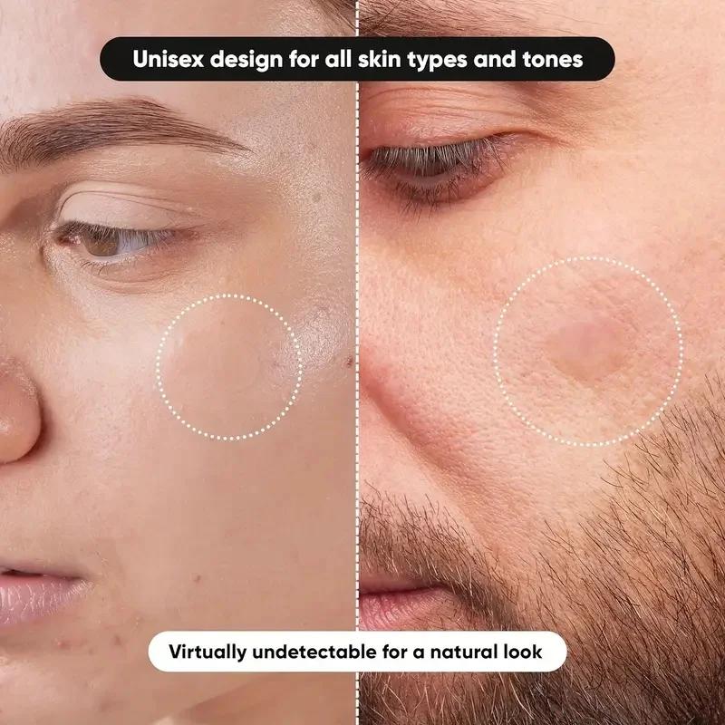 360 pieces/box acne patches -  - Massage recension och pris